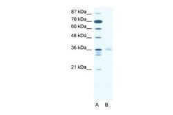 LHX3 Rabbit anti-Human, Polyclonal, Novus Biologicals 0.1 mL | Buy Online | Novus Biologicals | Fisher Scientific